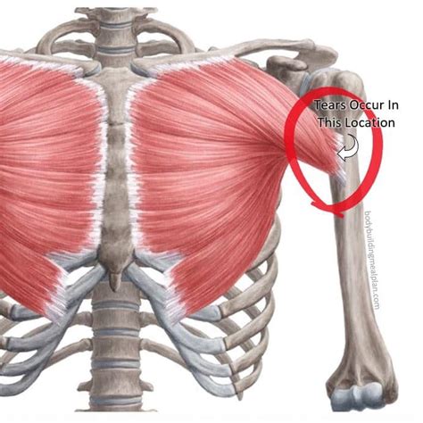 pectoralis minor tear test|pec tear recovery without surgery.